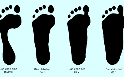 Cách chọn giày theo dáng Chân và Cơ thể