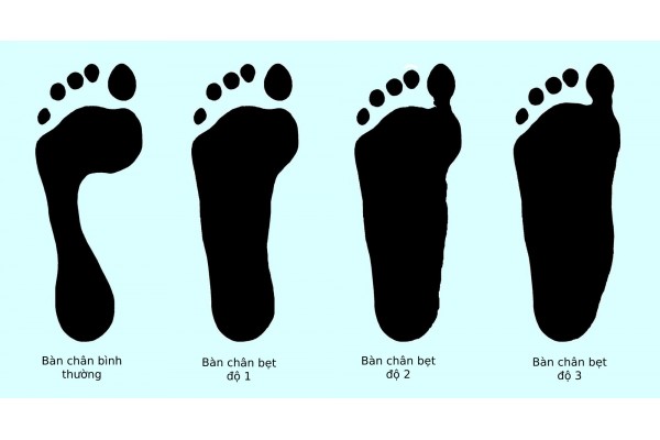 Cách chọn giày theo dáng Chân và Cơ thể