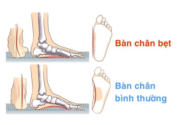 Top 5 Đôi Giày Nike Chính Hãng Có Form Rộng Cho Người Chân Bè