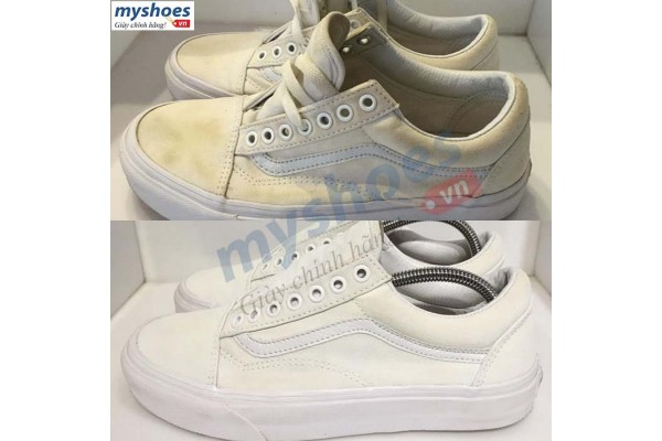 Khắc phục giày bị ố vàng của bạn bằng 5 cách đơn giản nhất