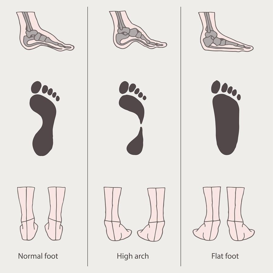 hình dạng bàn chân